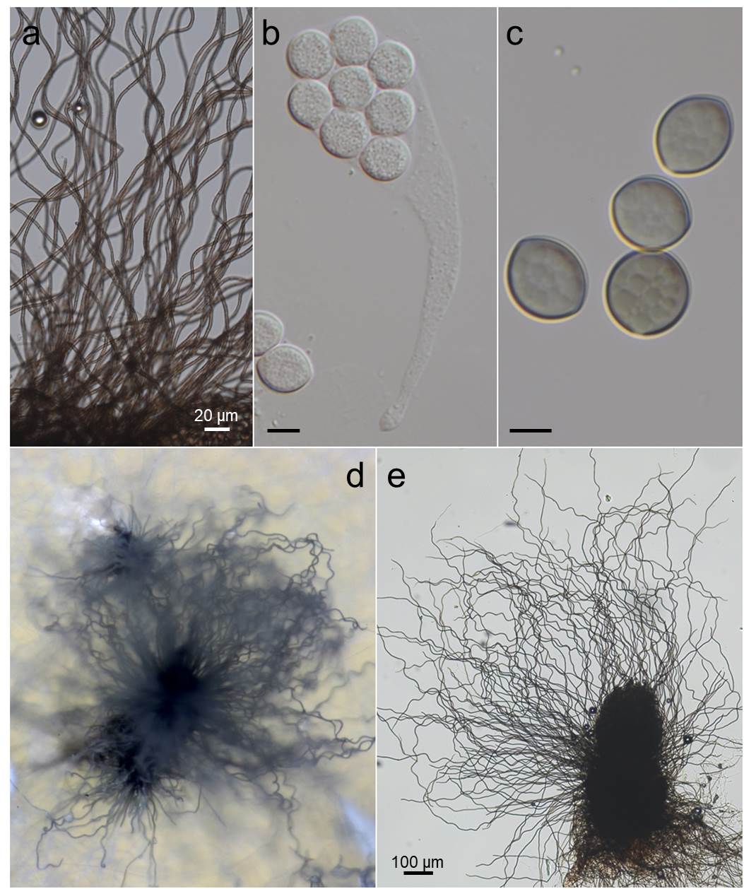 Chaetomium Globosum Chaetomium Globosum