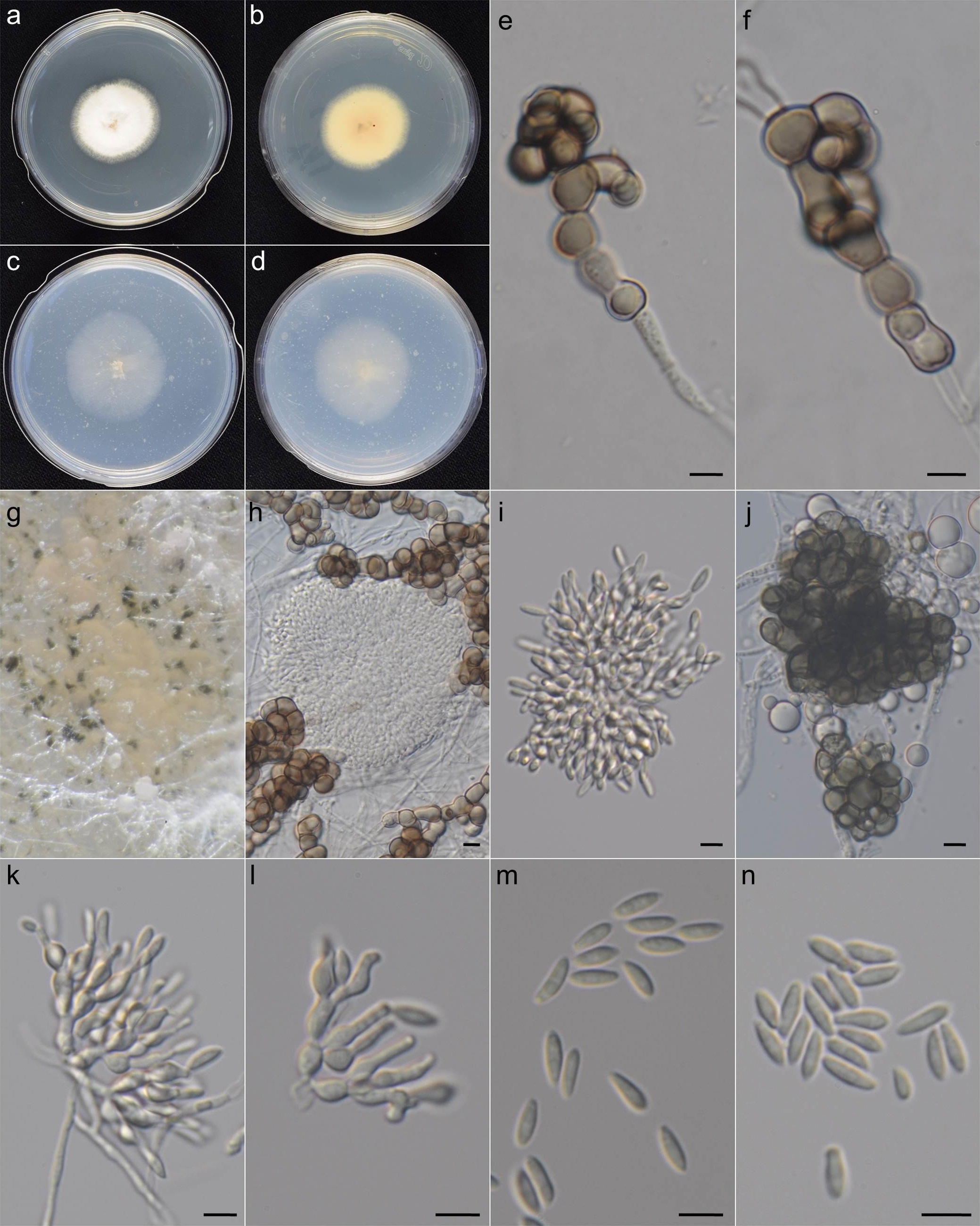 Microdochium poae